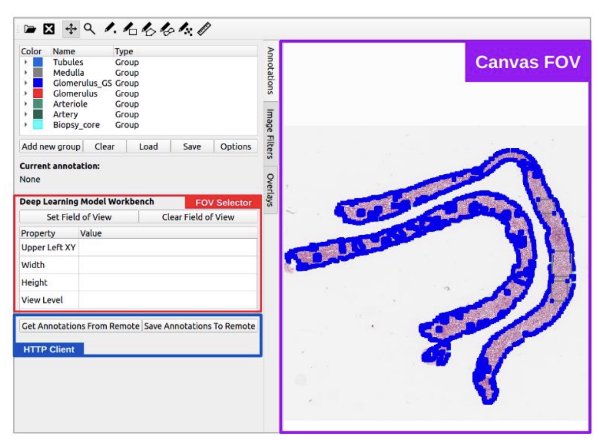 Auto-Annotation of Pathology Images